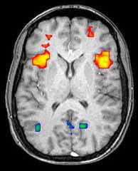 fmri.jpg