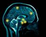 brain scan